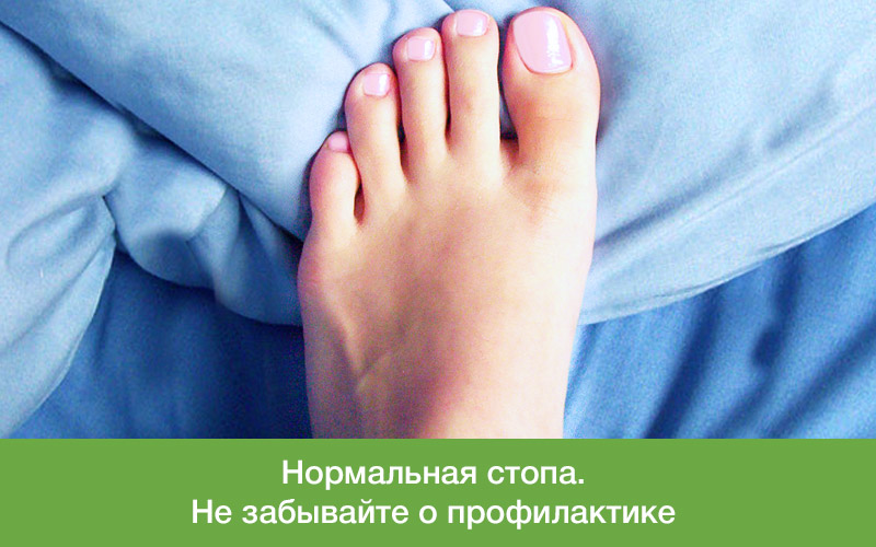 Что такое молоткообразная деформация пальцев стопы?